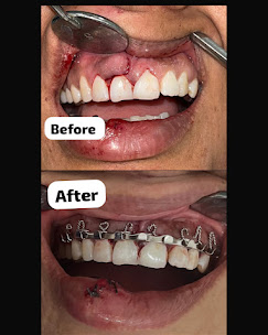 Clinical Case